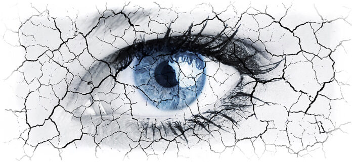 dry-eye-700×321